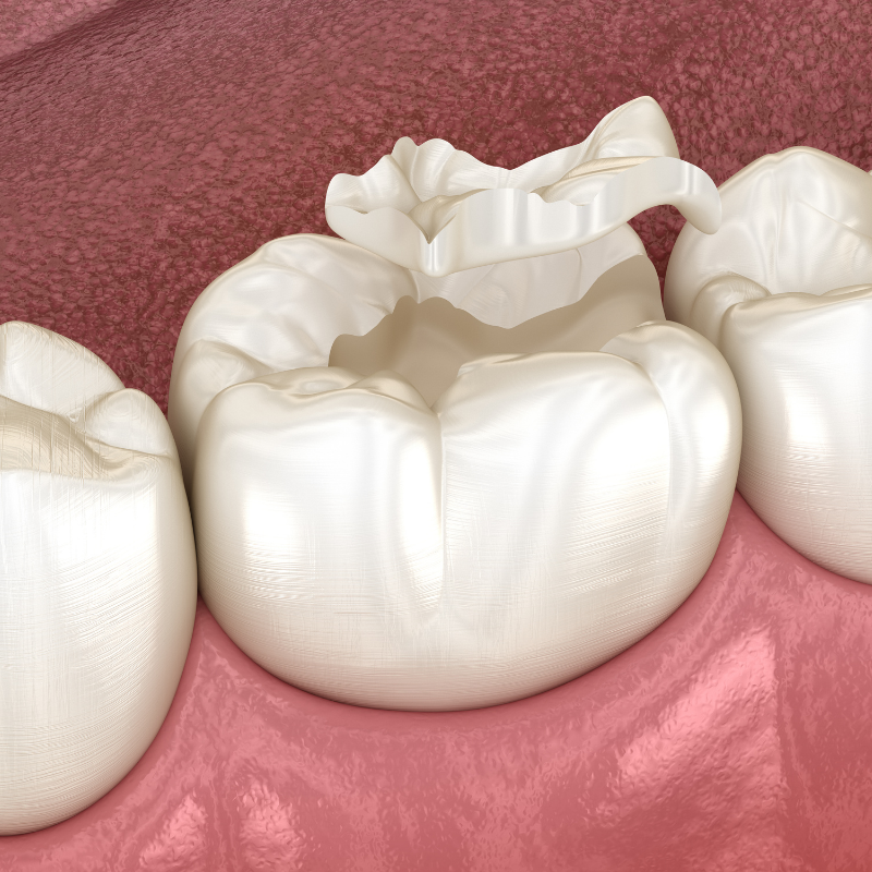 Fort Dental Center